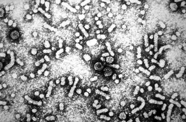 Micrographie électronique, la présence, l'hépatite, le virus, dane, particules, virions